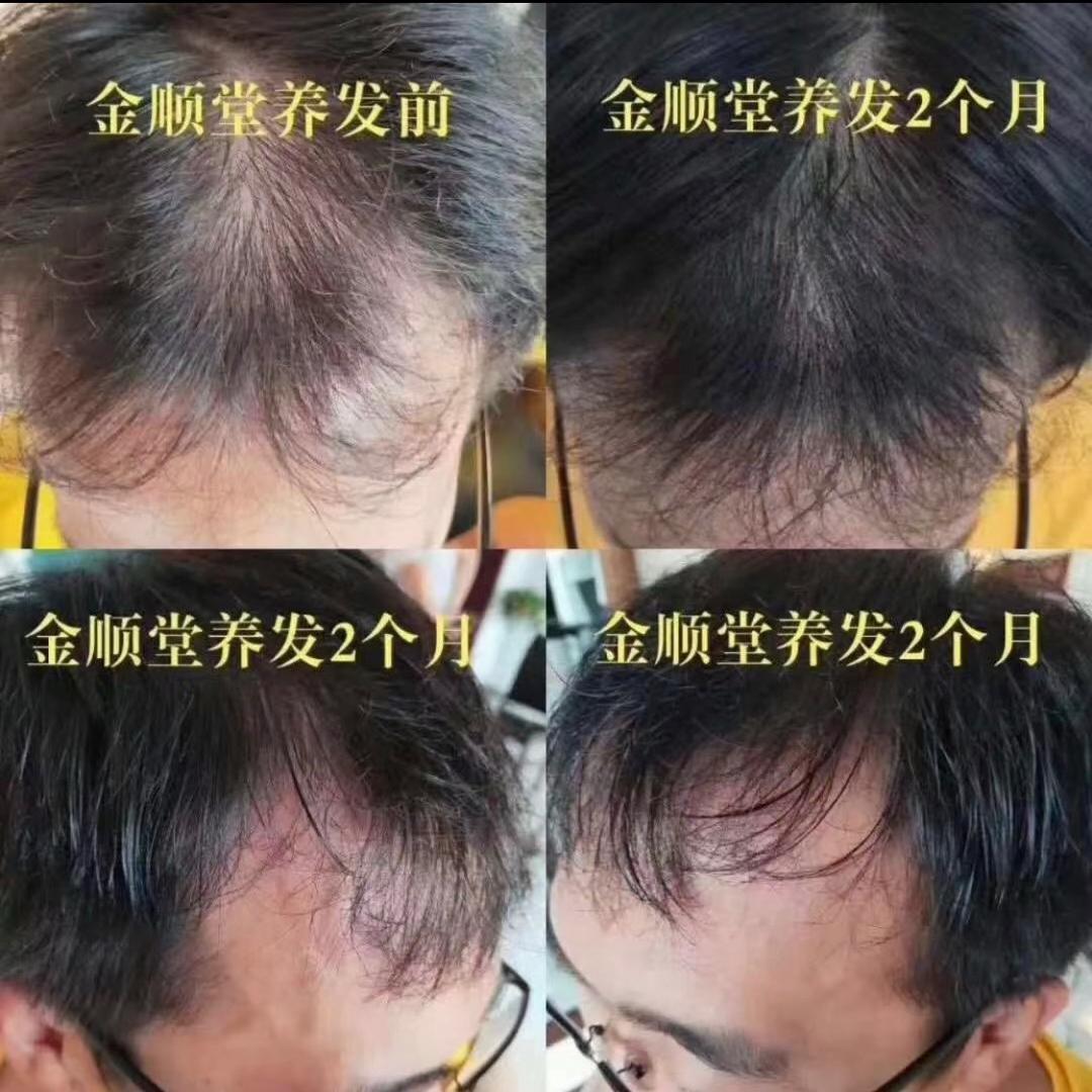 可泉头疗养发馆