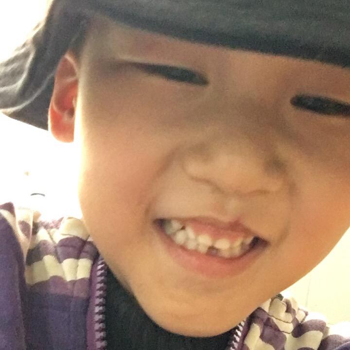 彤
