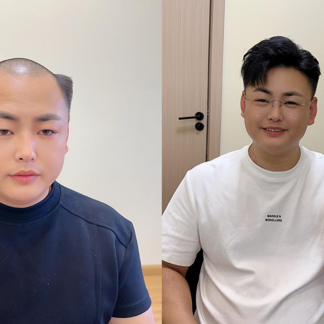 火鹏胡子哥28年定制专利假发官方号