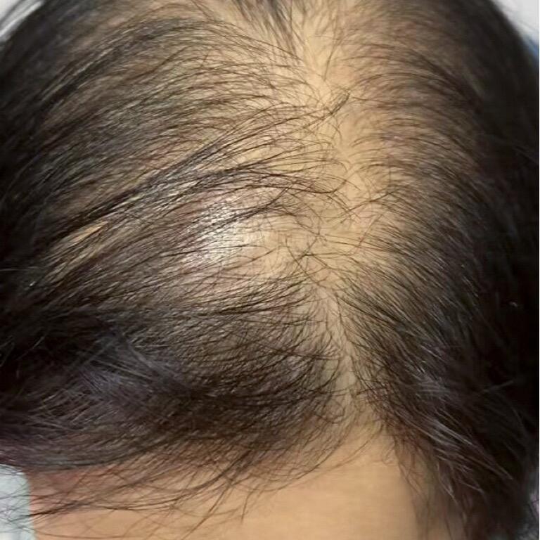 欢姐自用养发推荐