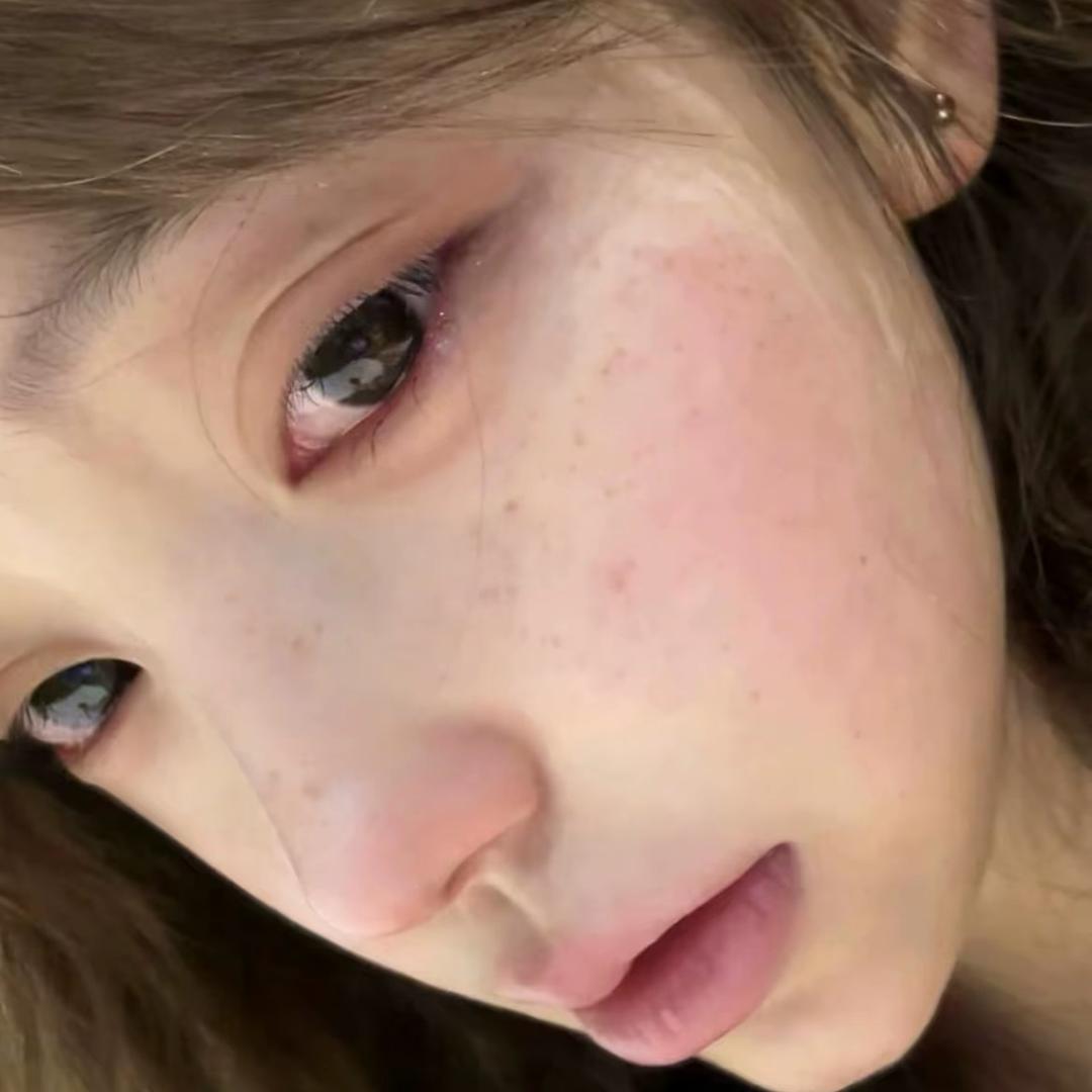 小美