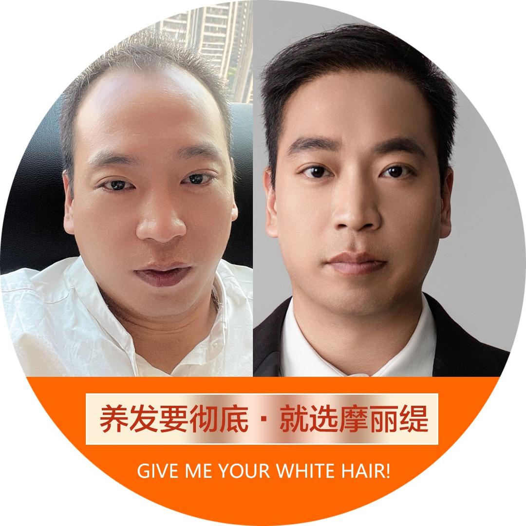 摩丽缇健康养发中心