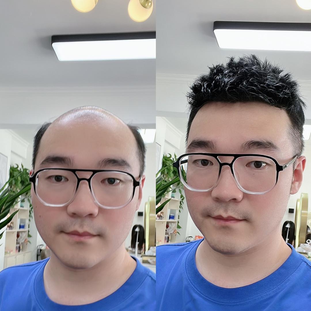 张掖涛歌补发假发