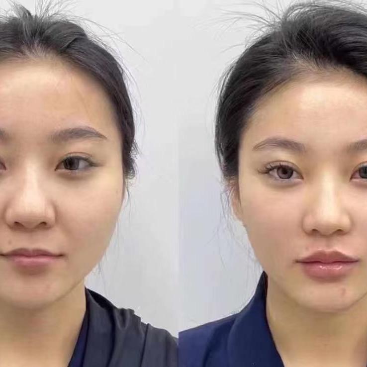 产妈妈美容