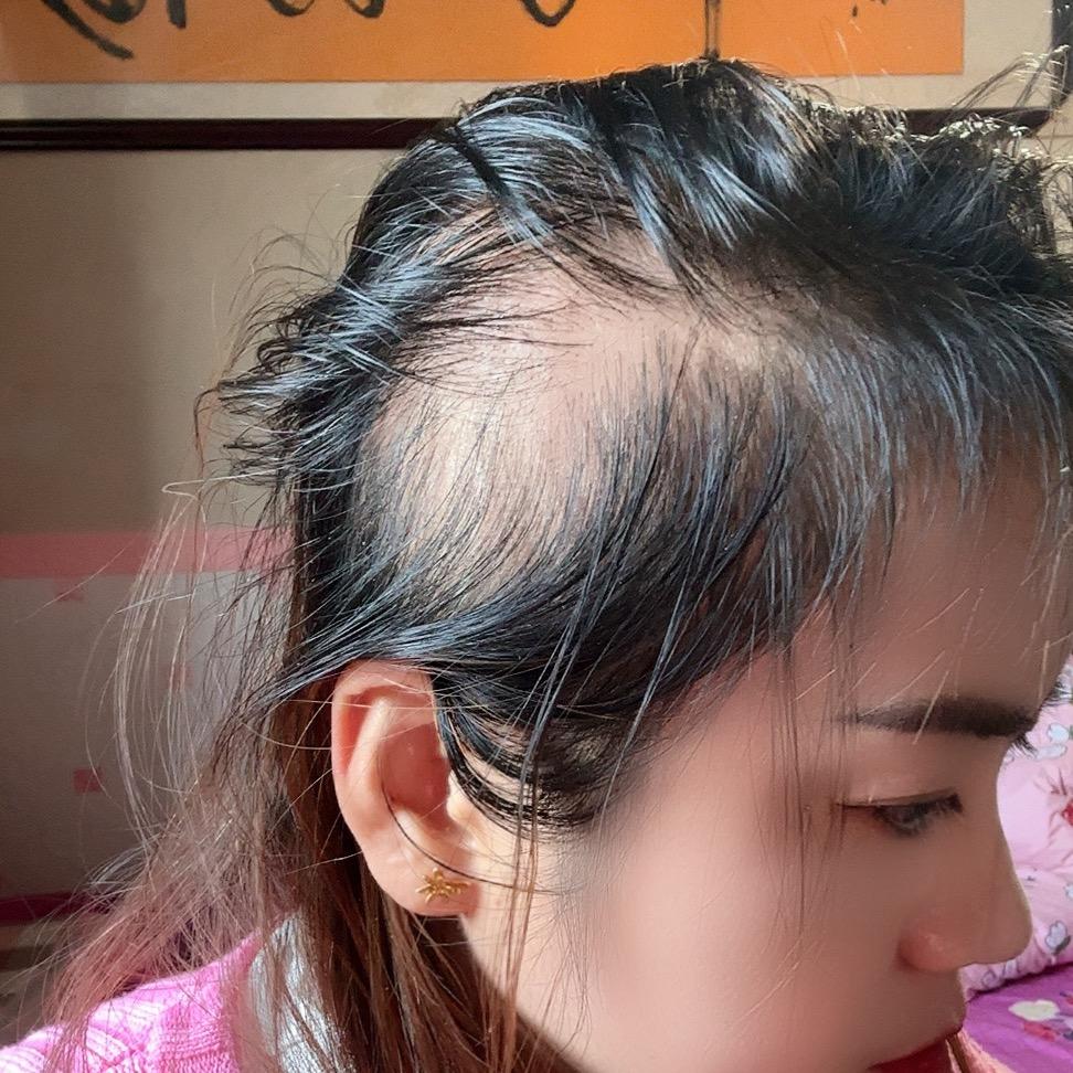 胡蝶吖