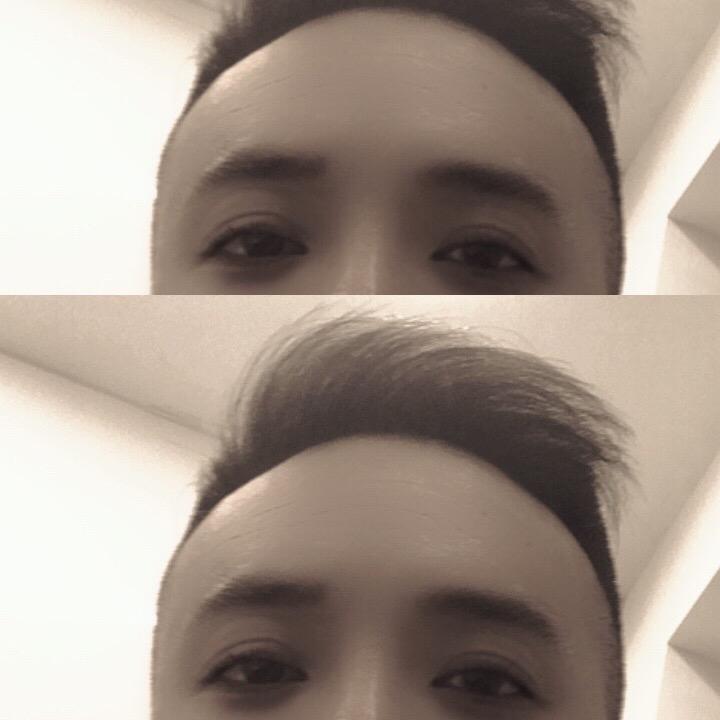 探涨