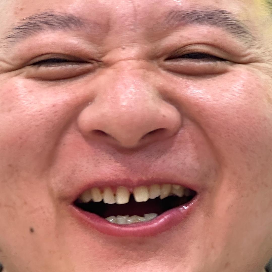 小红