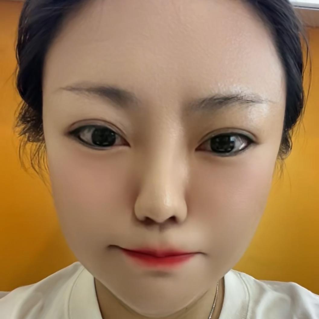 小恩