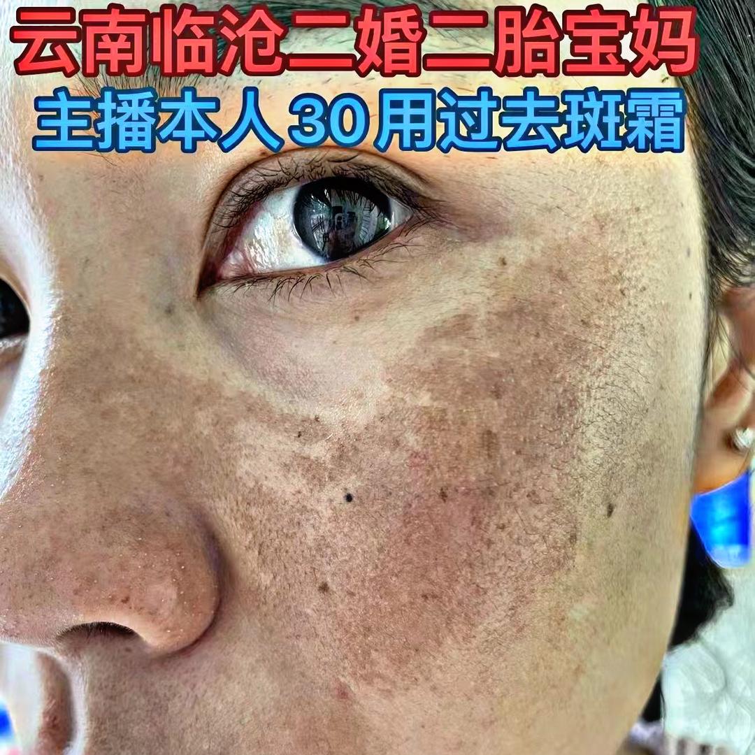 悦艾优选