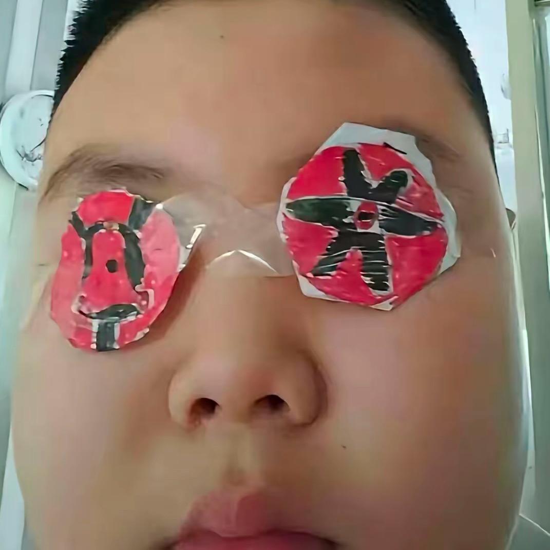 血轮眼鼻祖