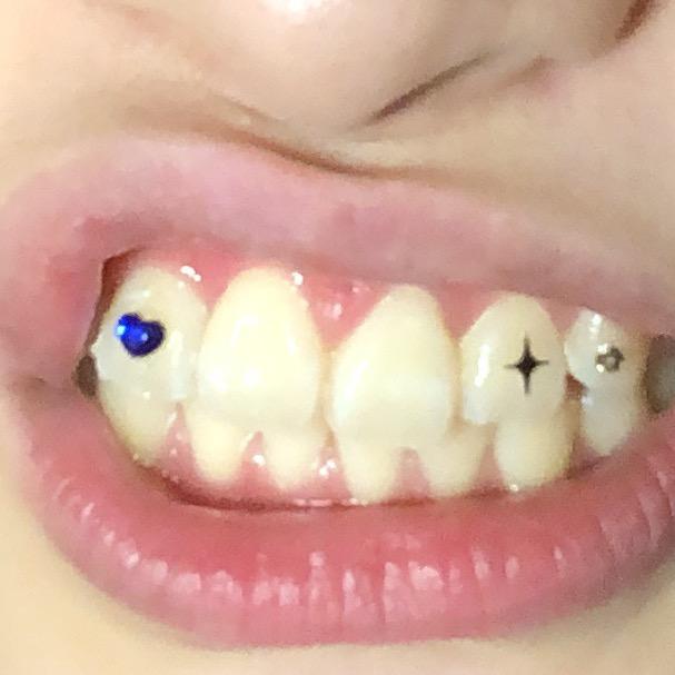 我的牙好疼