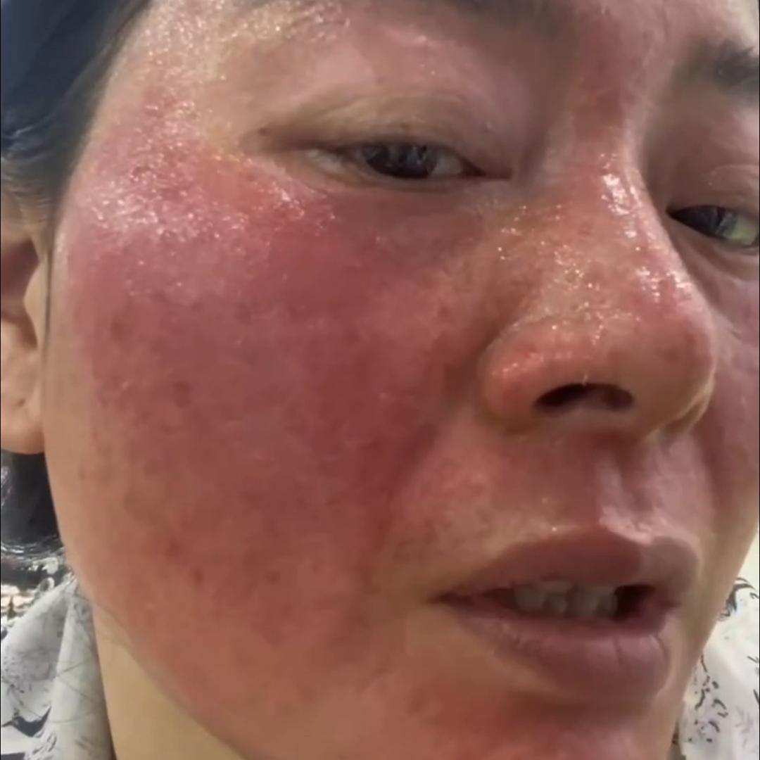 希皙