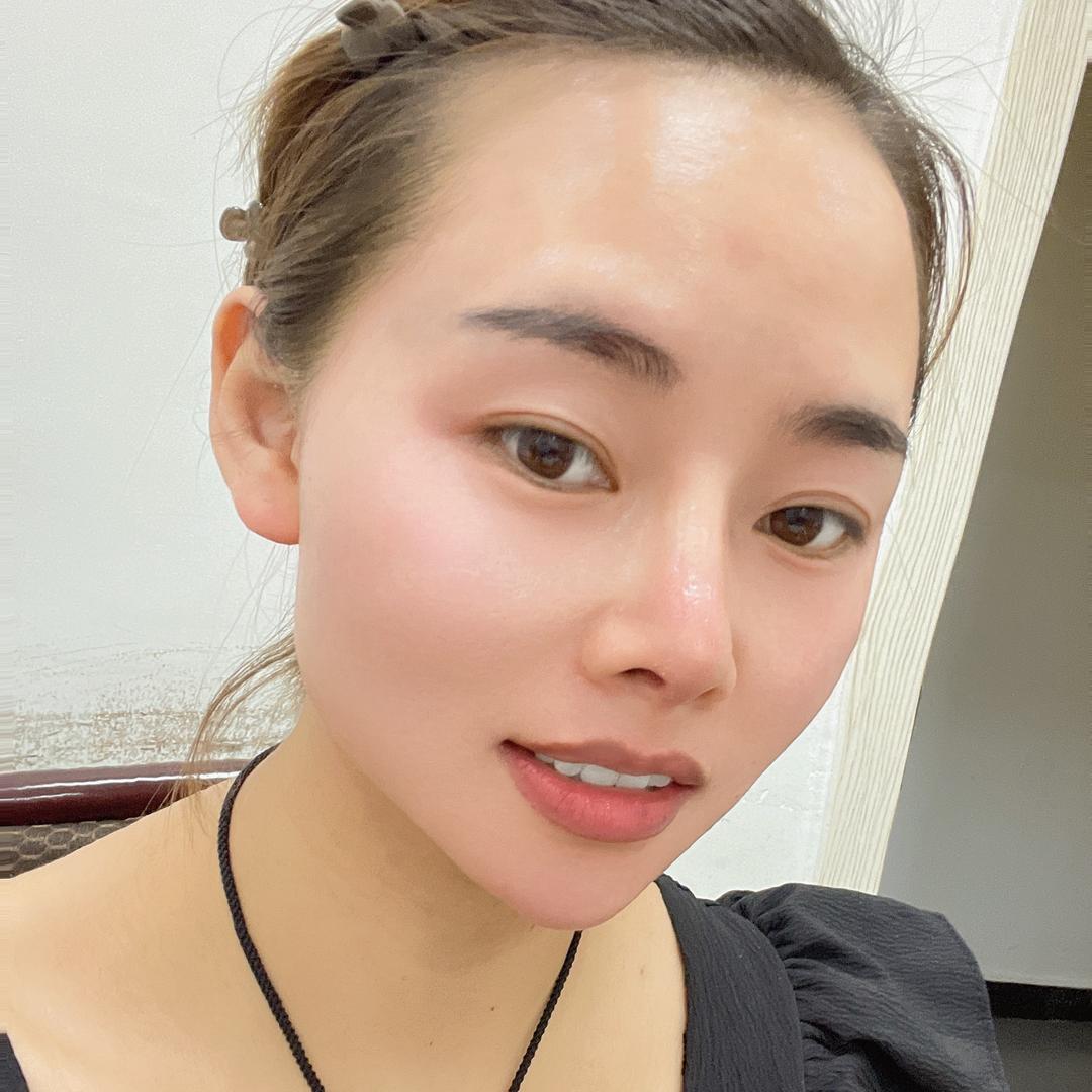 美白祛斑祛痘祛黄提亮肤色遇上我你不会后悔