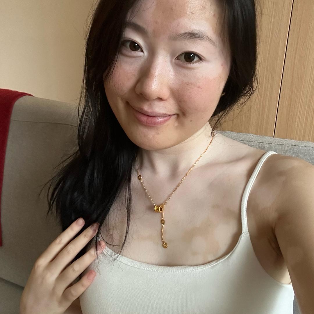 白白女孩877