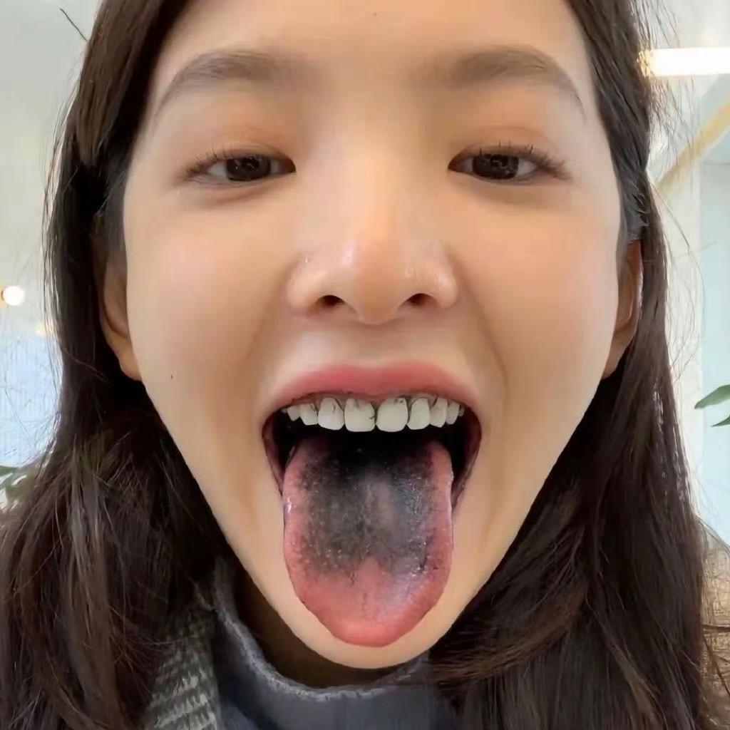 一只雯子^