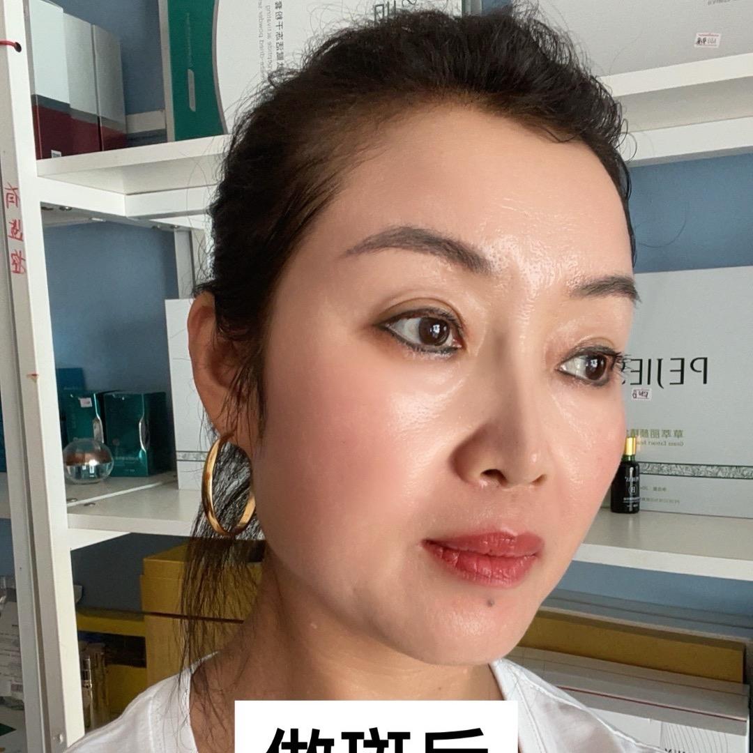 如姐（班痣瘦身调肩颈）