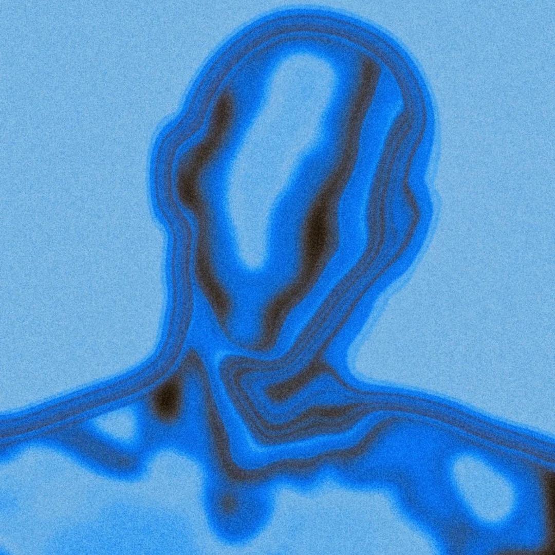 泡泡