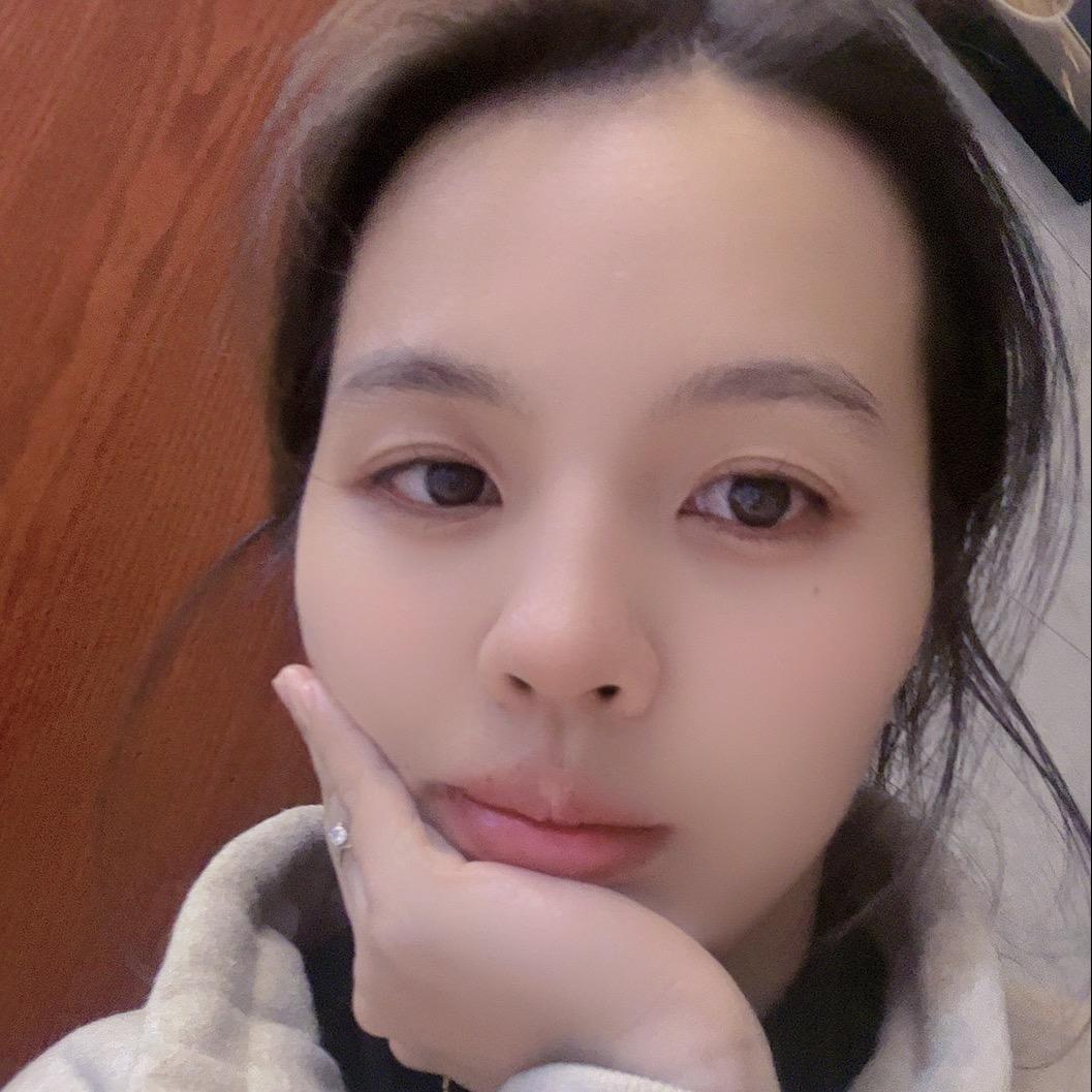 A@雯