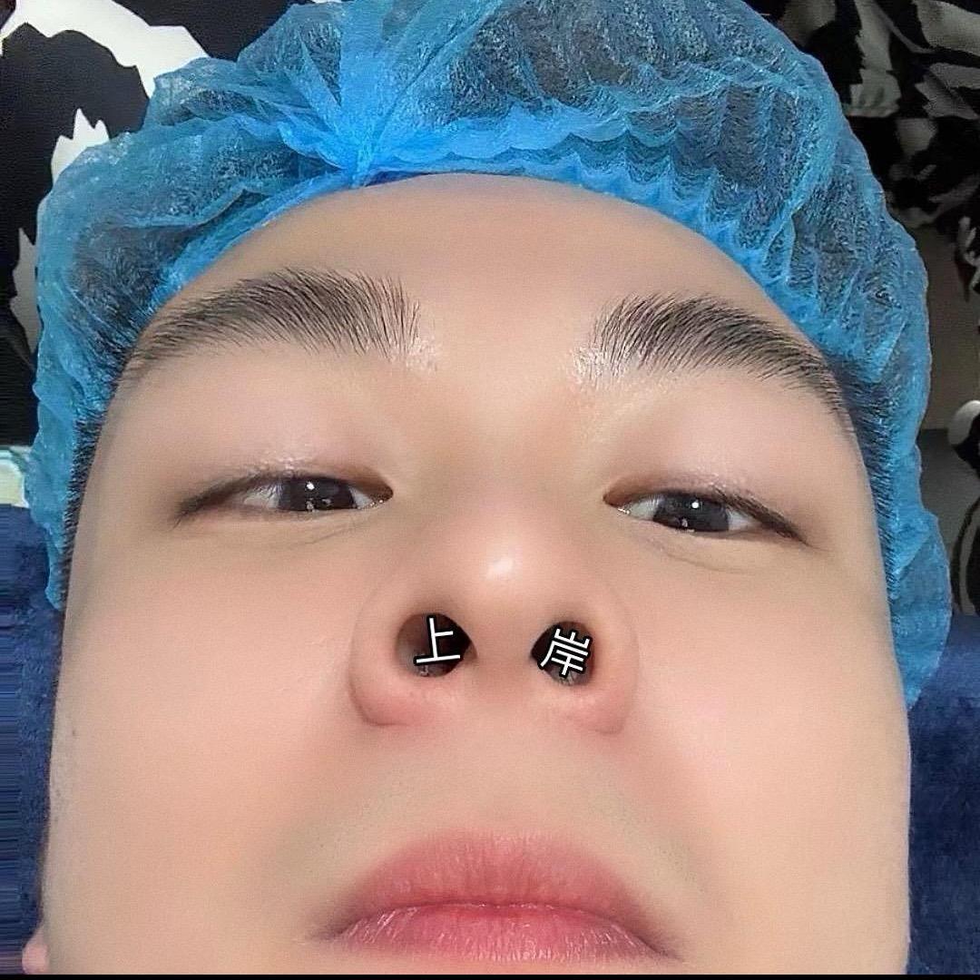 男护老薛(备考教学版)