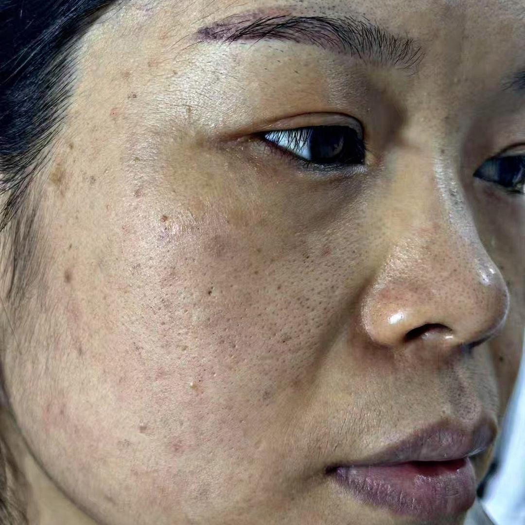 张莉莉护肤
