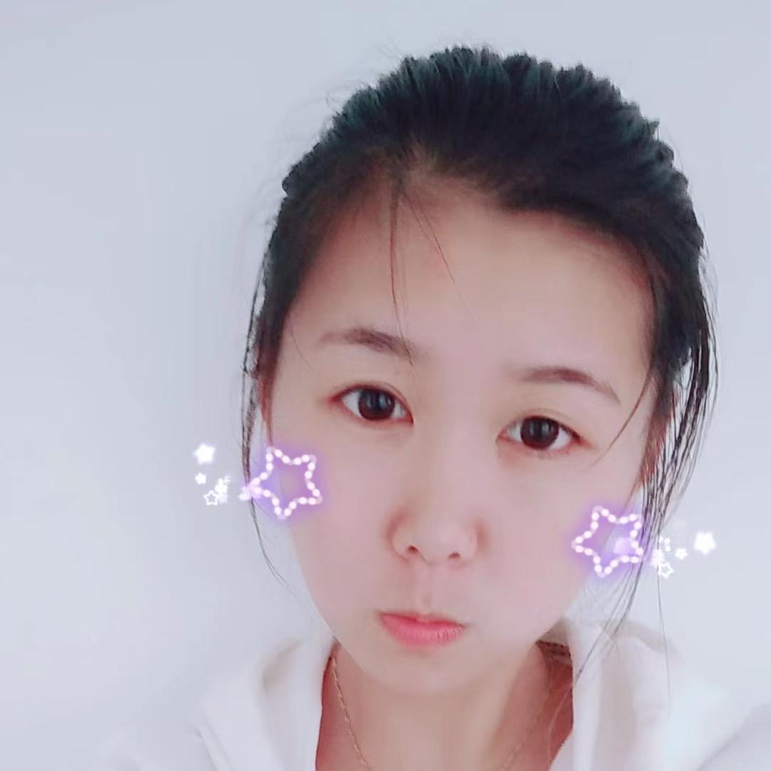 金刚网纱窗批发