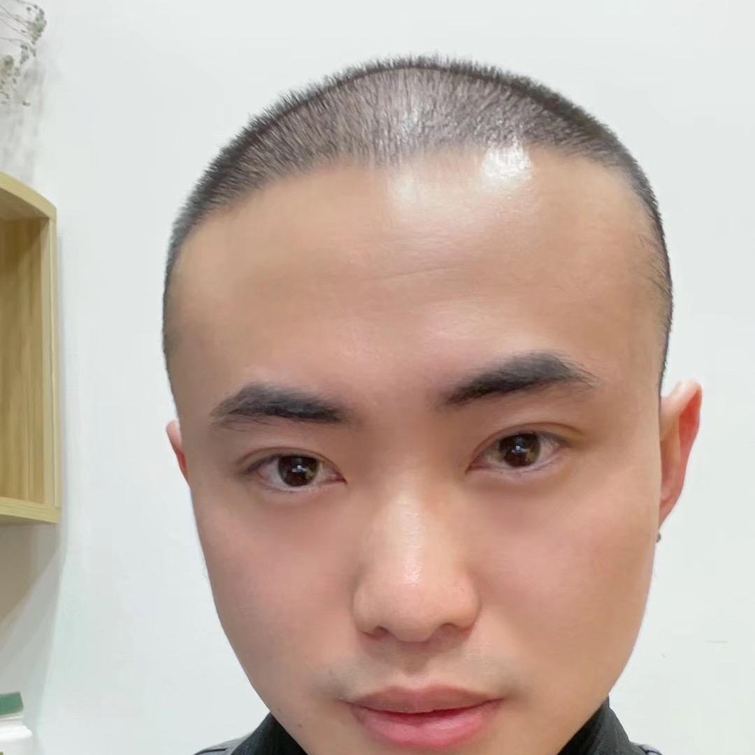 秃头老鸡王传媒