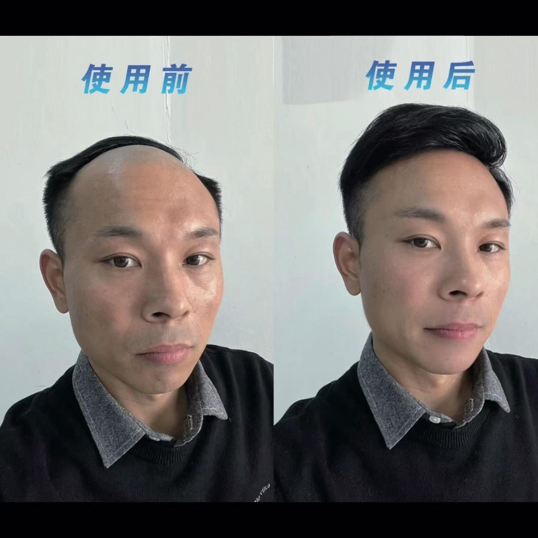 杨威（顶剪）假发定制