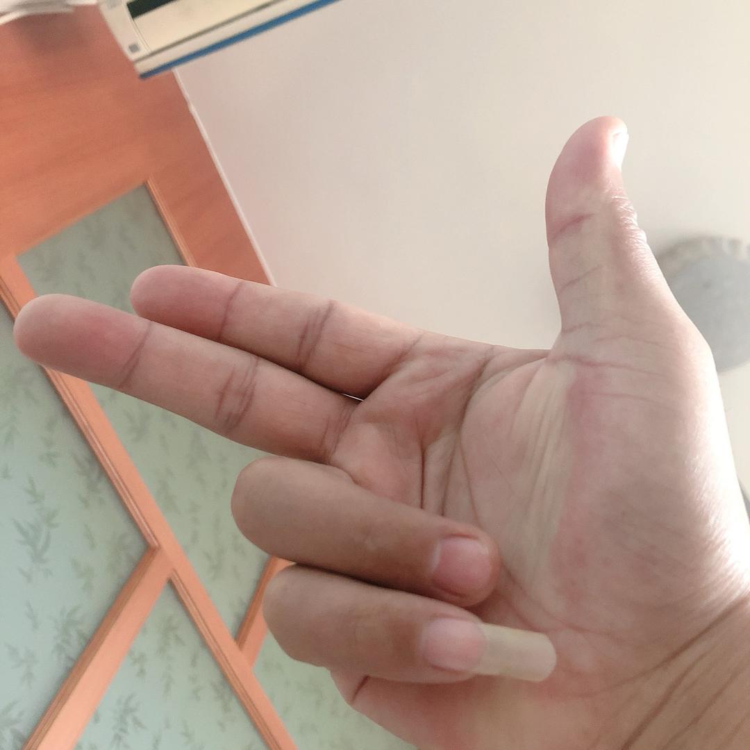 续集、