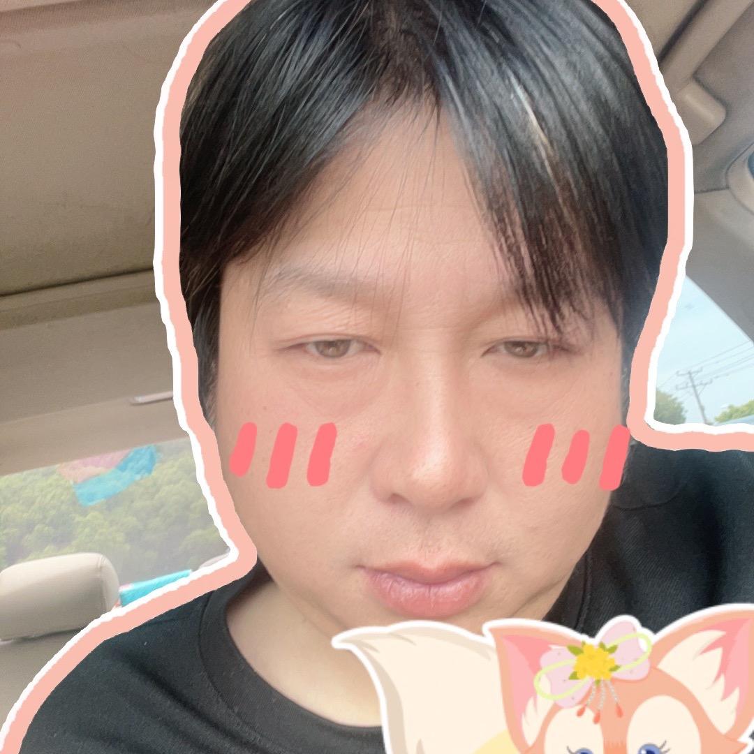 小阿飞