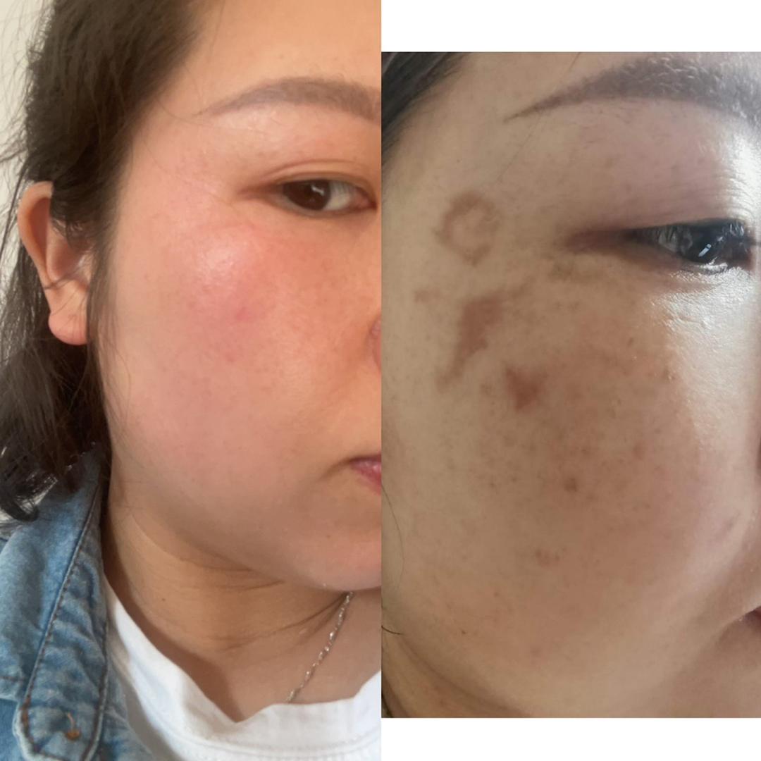 伊倩美容皮肤管理官方号