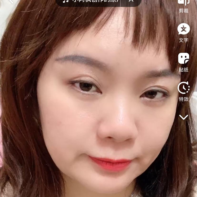 阿玲