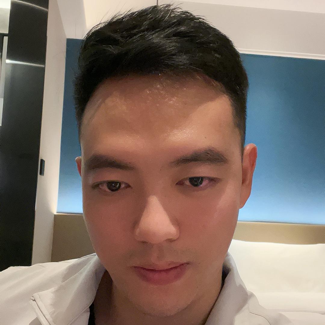 植发阿瑞