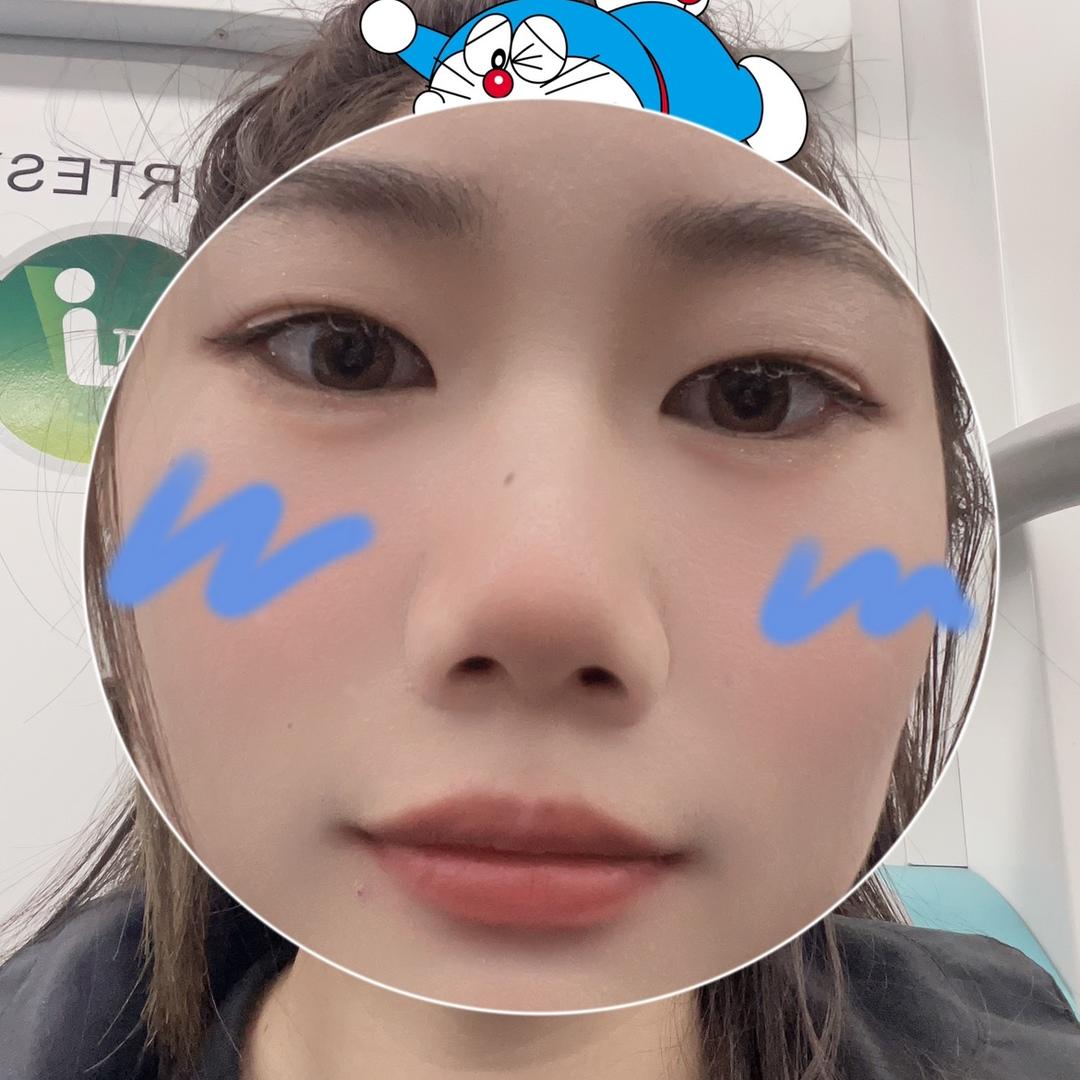 小张同学·