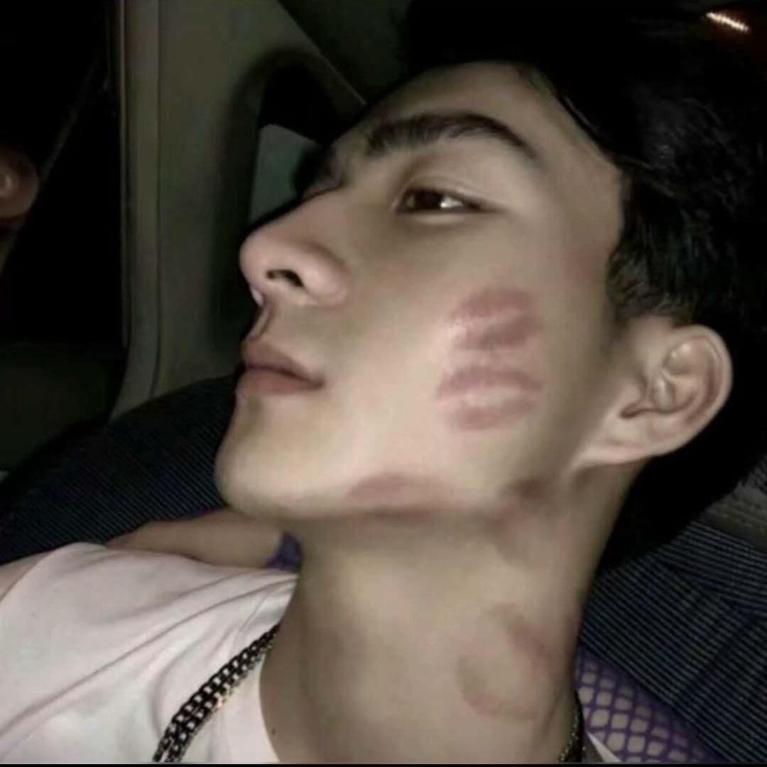 -D