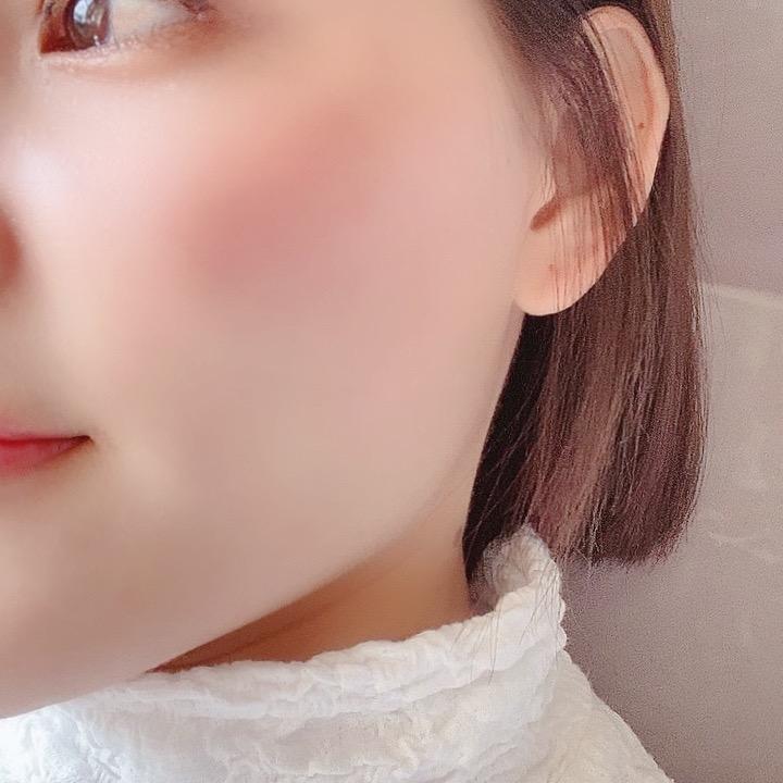 *         费费宝   ❉