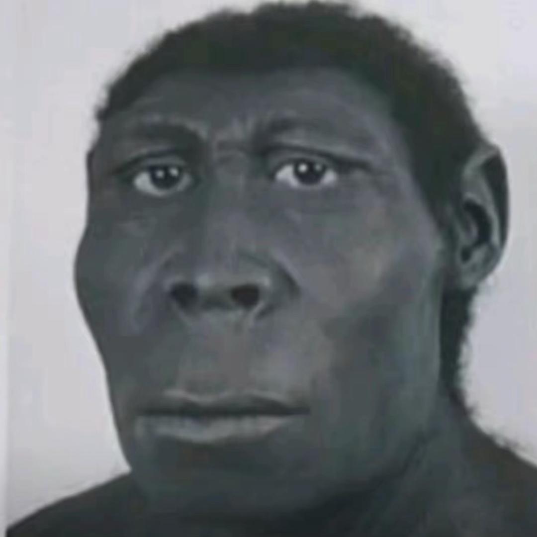 美丽绝育大蟑螂