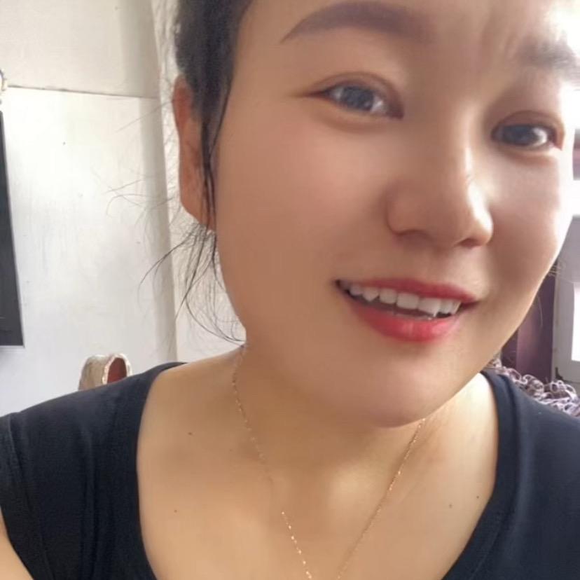 张   美   女🌹🌹🌹