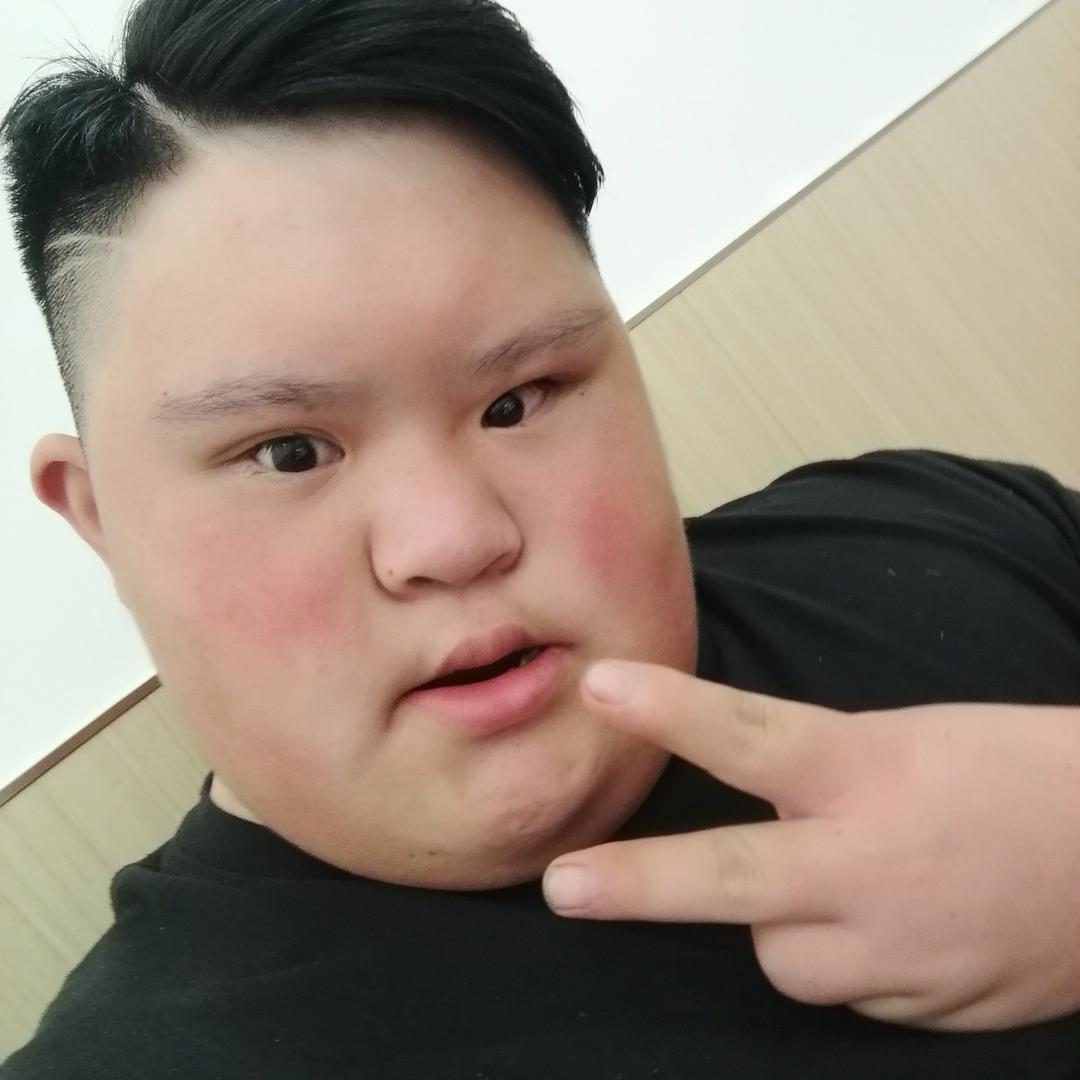 唐氏综合症 二哥