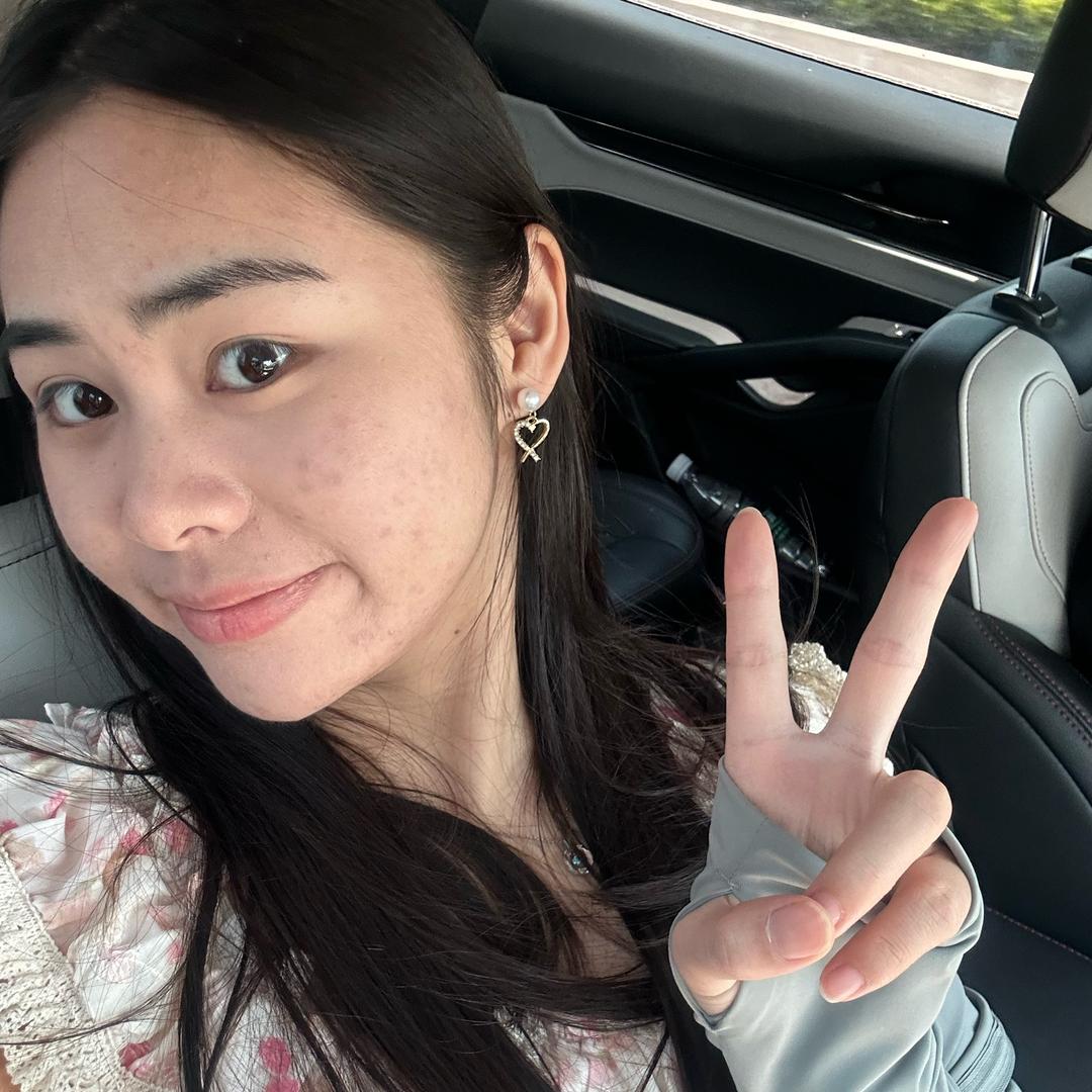 小聂不想长痘