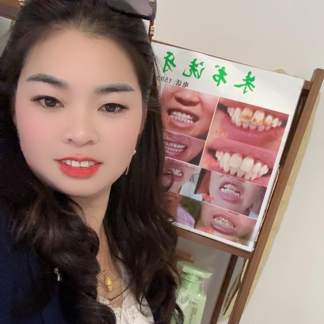 朱书。洗牙简单就用棉签
