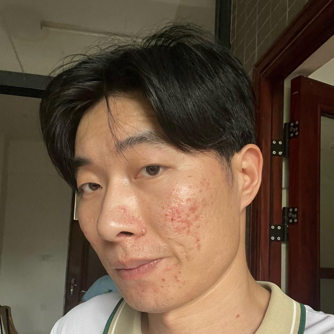 夏琪尔