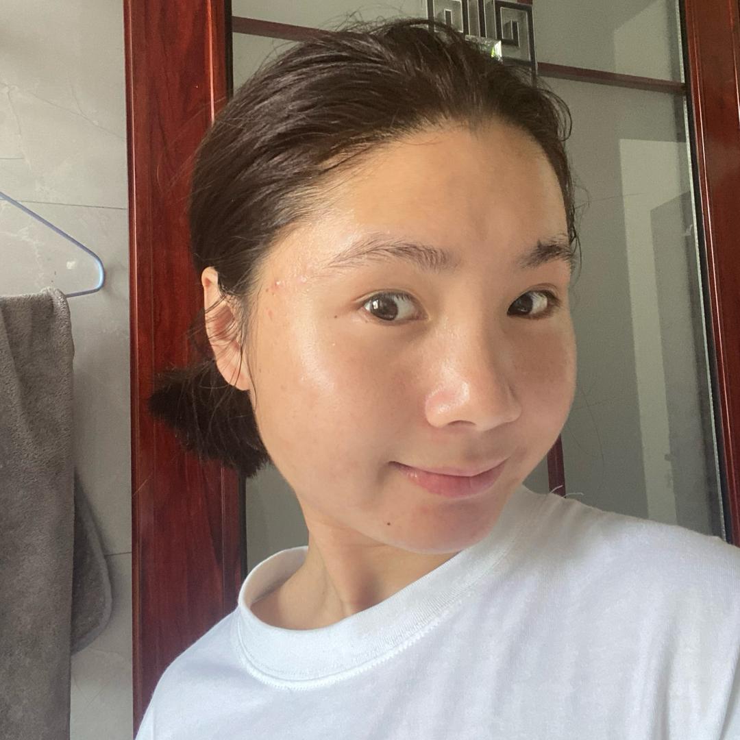 是小卓呀！（战痘上岸）