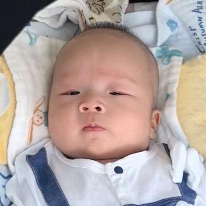 一一真有双眼皮