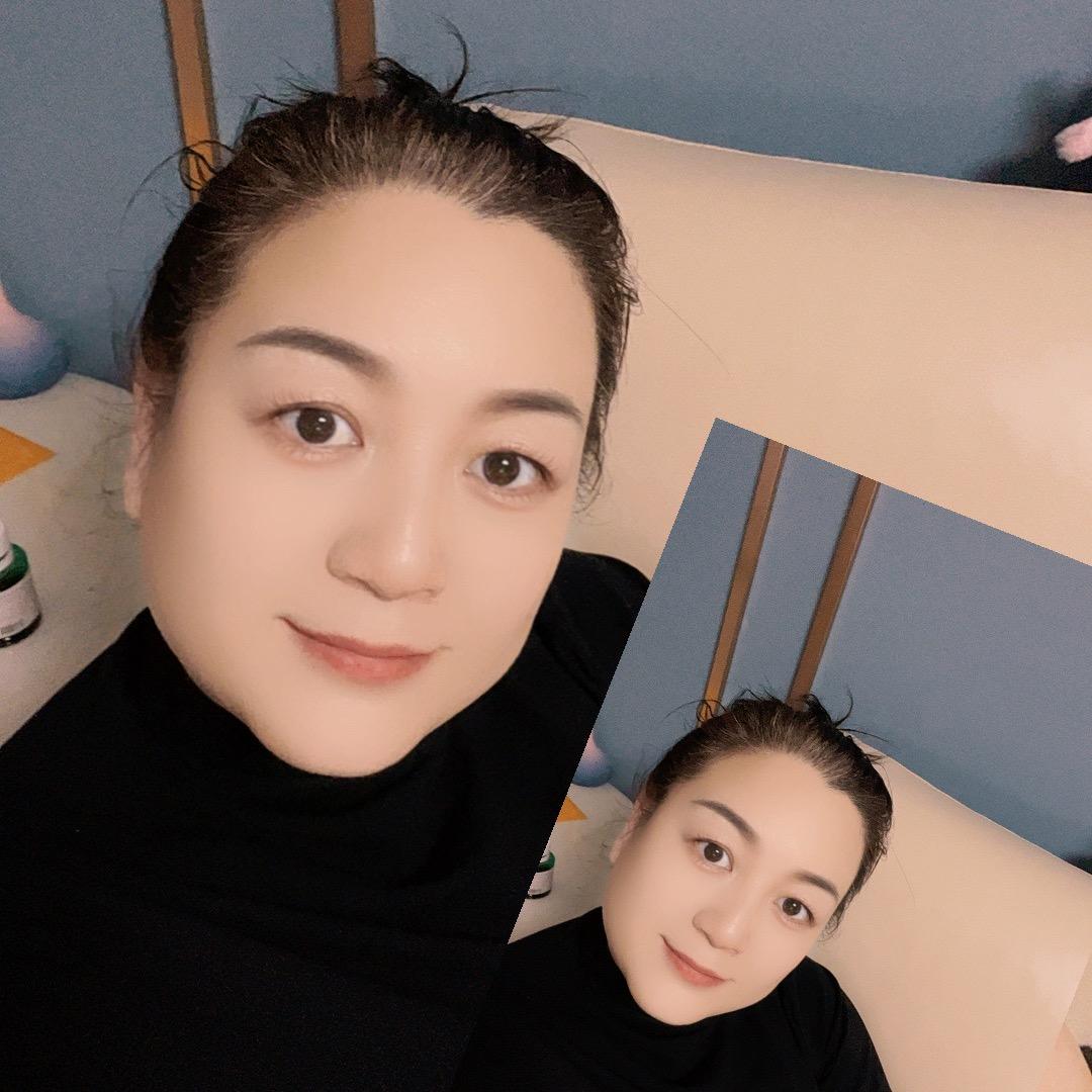 李娜