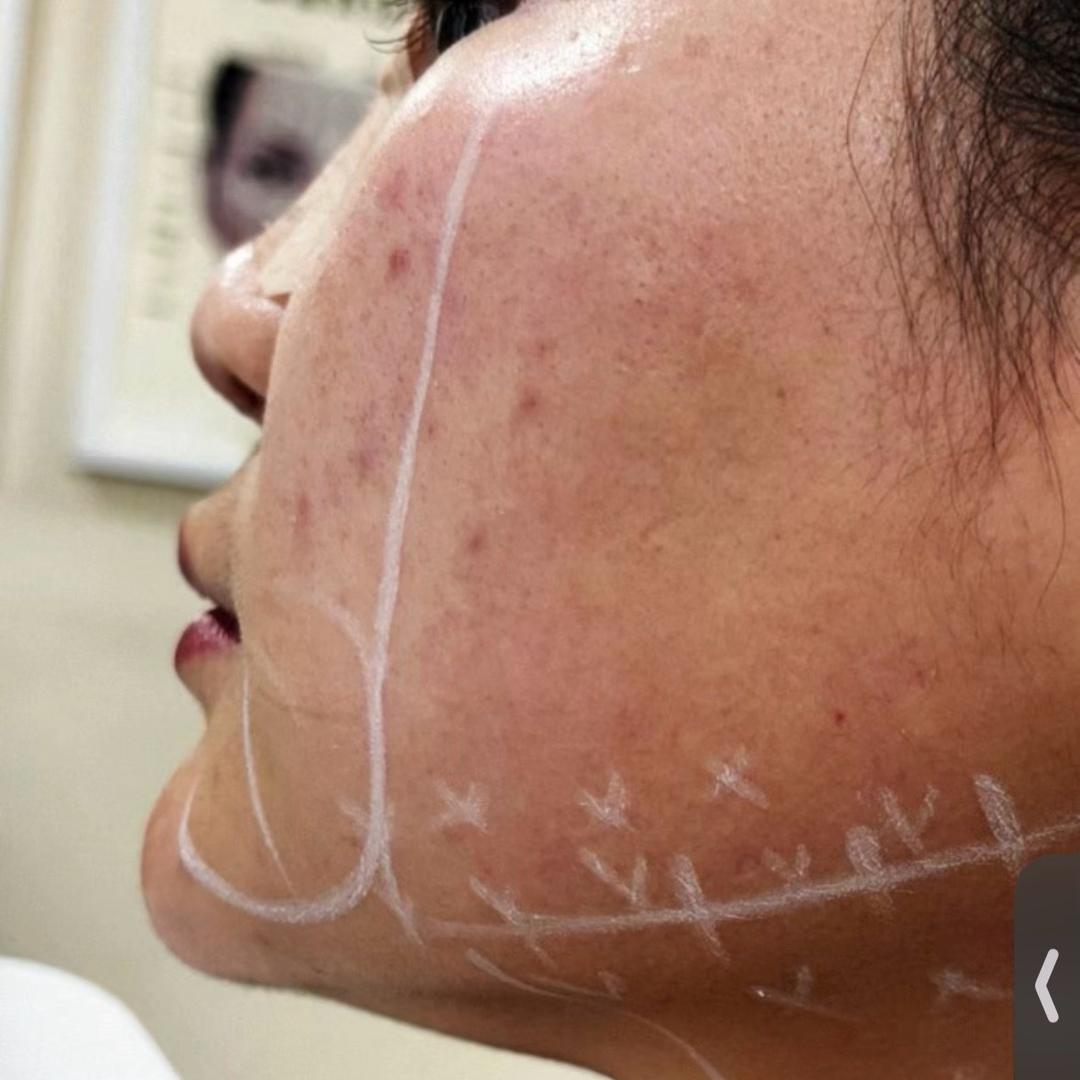 天门米宝宝素颜肌打造