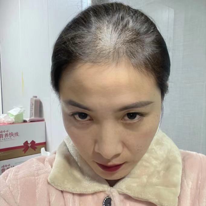 养发达人苗苗