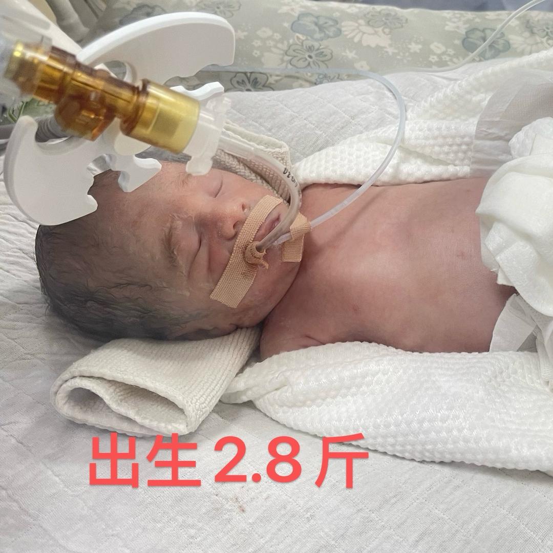 2.8斤小小圳成长记