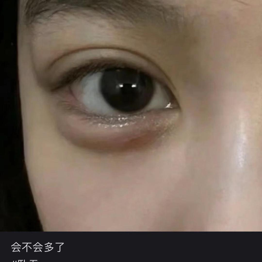 胖妮