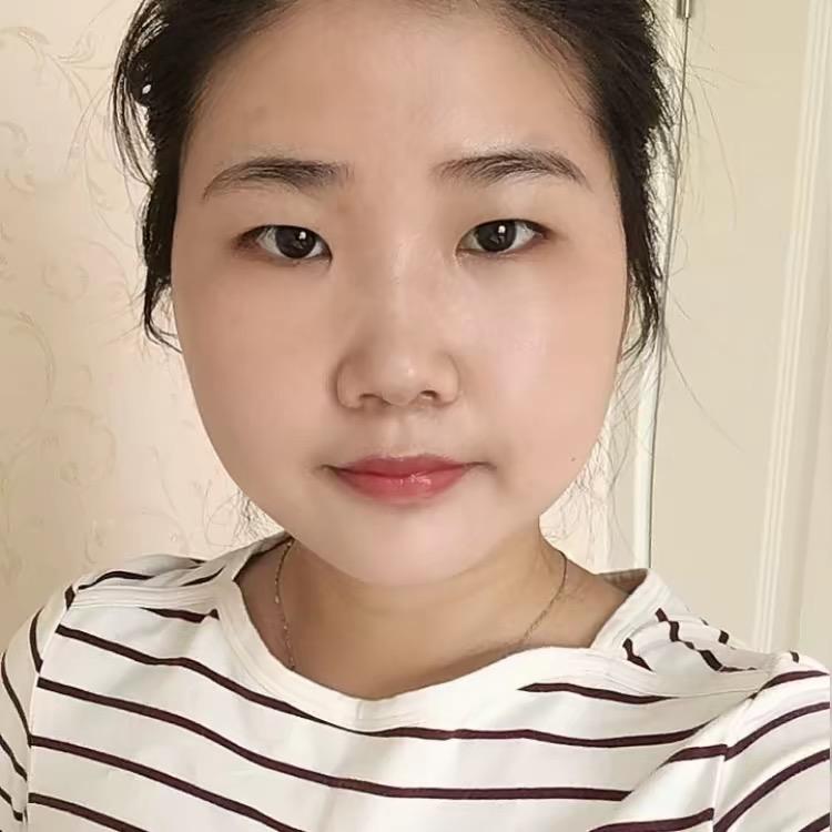 是单眼皮九姨哇