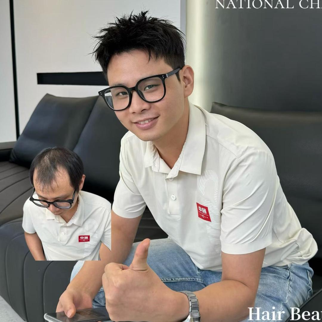 肇庆补发假发店（可上门）